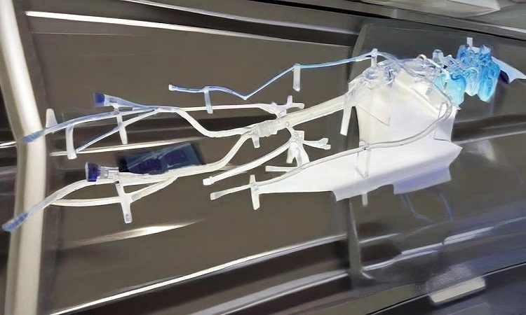 顱內(nèi)血管介入模型